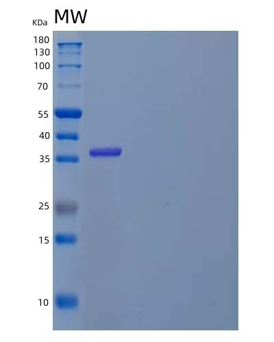 Human IL5RA (Interleukin-5 Receptor Subunit Alpha) - Recombinant Protein