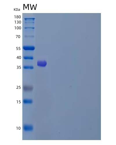 Human LAMP1 (Lysosome-Associated Membrane Glycoprotein 1) - Recombinant Protein