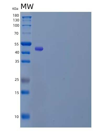 Human LRRN2 (Leucine-Rich Repeat Neuronal Protein 2) - Recombinant Protein
