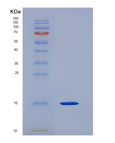 Human EIF1B (Eukaryotic Translation Initiation Factor 1B) - Recombinant Protein