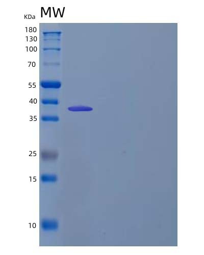 Human CDK2 (Cyclin-Dependent Kinase 2) - Recombinant Protein