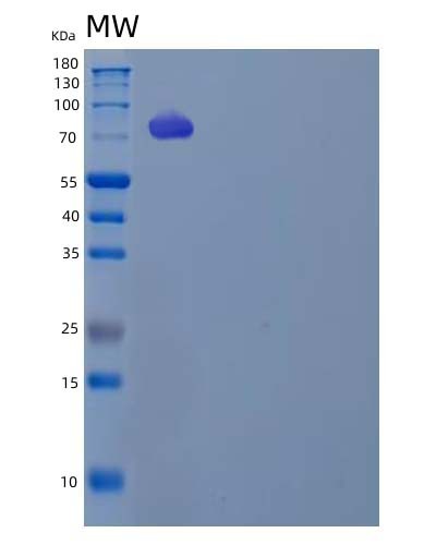 Human LDLR (Low-Density Lipoprotein Receptor) - Recombinant Protein