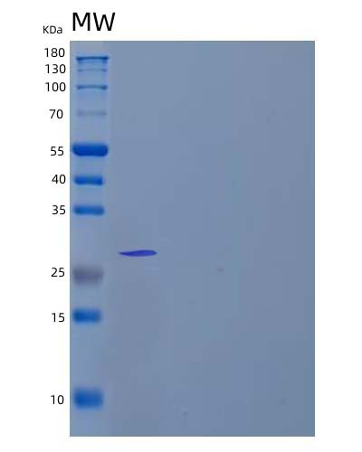 Human KLK7 (Kallikrein-7) - Recombinant Protein