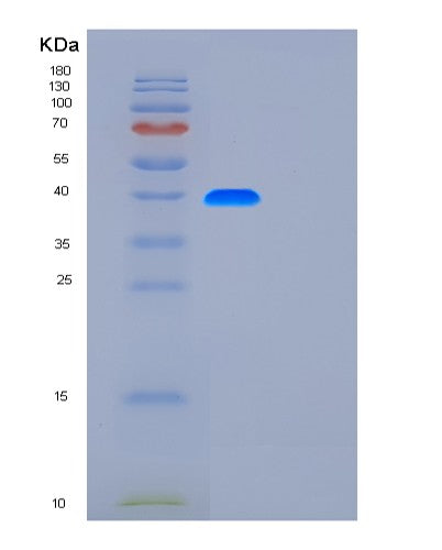 Human FUT3 (3-Galactosyl-N-Acetylglucosaminide 4-Alpha-L-Fucosyltransferase Fut3) - Recombinant Protein