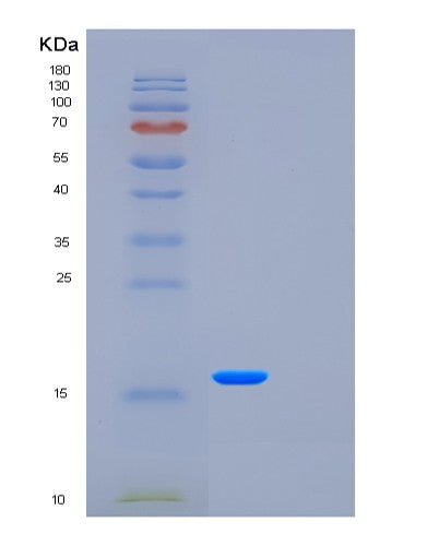 Human FXYD5 (Fxyd Domain-Containing Ion Transport Regulator 5) - Recombinant Protein