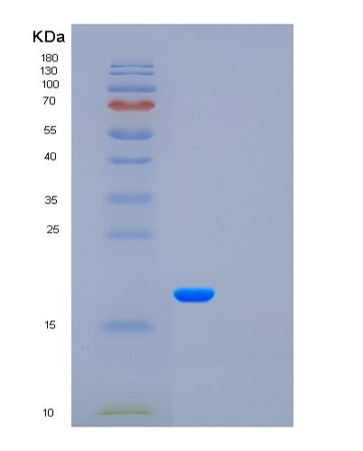 Human CSF3 (Granulocyte Colony-Stimulating Factor) - Recombinant Protein