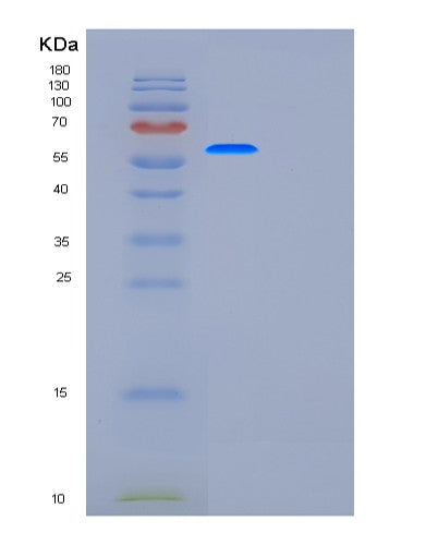 Human G6PD (Glucose-6-Phosphate 1-Dehydrogenase) - Recombinant Protein