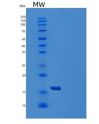 Human LGALS1 (Galectin-1) - Recombinant Protein