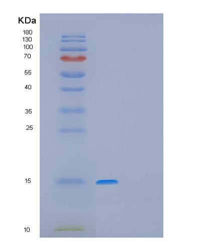 Human GAGE12F (G Antigen 12F) - Recombinant Protein