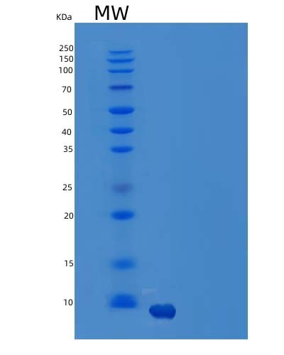 Human CCL14 (C-C Motif Chemokine 14) - Recombinant Protein