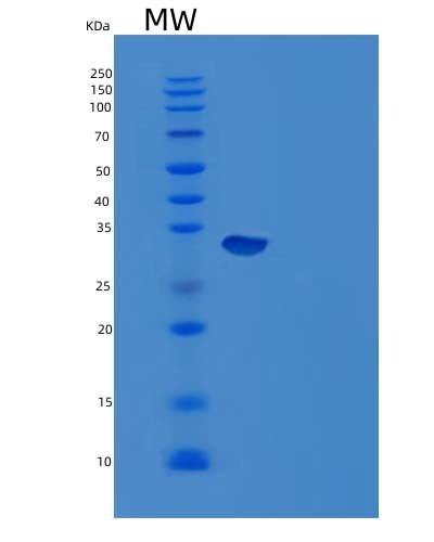 Mouse Ca12 (Carbonic Anhydrase 12) - Recombinant Protein