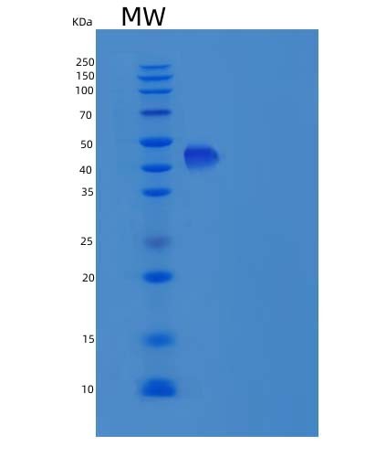 Human CST9L (Cystatin-9-Like) - Recombinant Protein