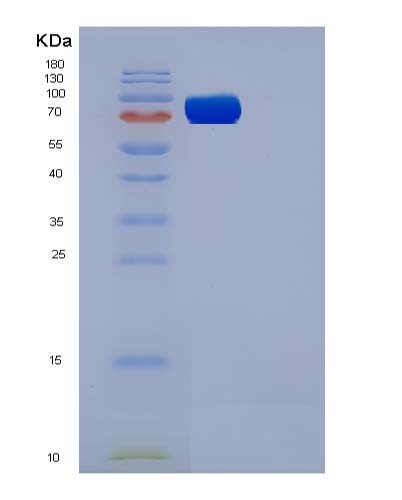 Mouse Flt4 (Vascular Endothelial Growth Factor Receptor 3) - Recombinant Protein