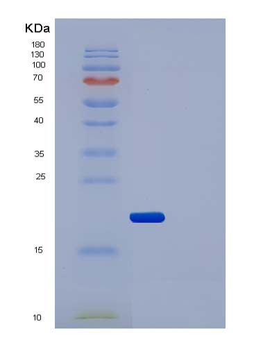 Human IL2RA (Interleukin-2 Receptor Subunit Alpha) - Recombinant Protein