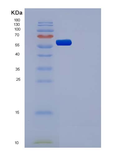Human CSF1R (Macrophage Colony-Stimulating Factor 1 Receptor) - Recombinant Protein