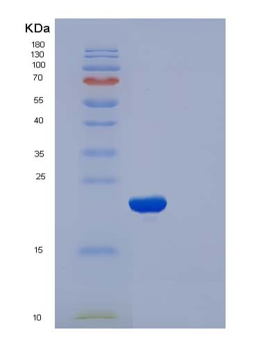Human CFL2 (Cofilin-2) - Recombinant Protein