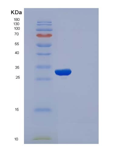 Human APOA1 (Apolipoprotein A-I) - Recombinant Protein