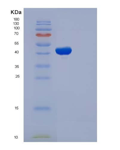 Human MAX (Protein Max) - Recombinant Protein