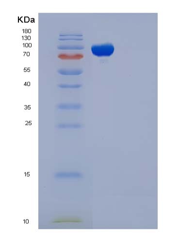 Human EED (Polycomb Protein Eed) - Recombinant Protein