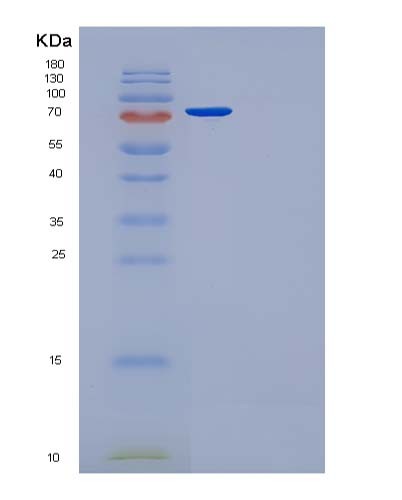 Human FN1 (Fibronectin) - Recombinant Protein
