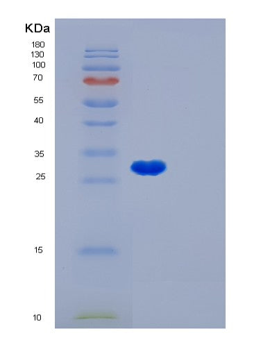Human LGALS3 (Galectin-3) - Recombinant Protein