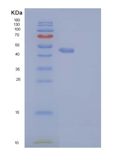 Human RAB27B (Ras-Related Protein Rab-27B) - Recombinant Protein