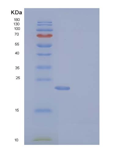 Human RAB27B (Ras-Related Protein Rab-27B) - Recombinant Protein