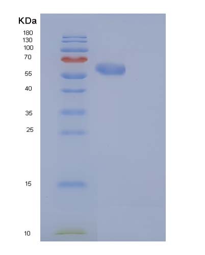 Human CAT (Catalase) - Recombinant Protein