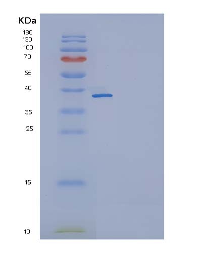 Mouse Il11 (Interleukin-11) - Recombinant Protein