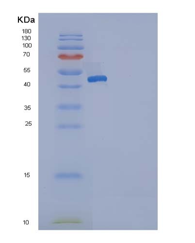 Human SERPING1 (Plasma Protease C1 Inhibitor) - Recombinant Protein