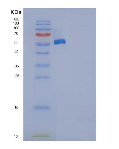 Human ANP32A (Acidic Leucine-Rich Nuclear Phosphoprotein 32 Family Member A) - Recombinant Protein