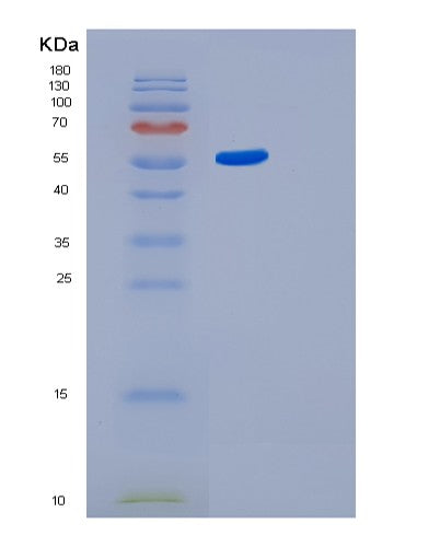 Human GBA3 (Cytosolic Beta-Glucosidase) - Recombinant Protein