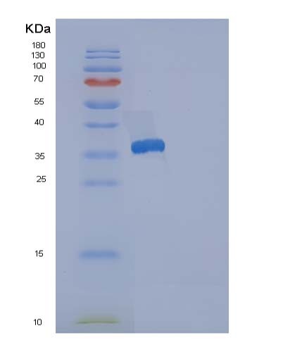 Human RCN3 (Reticulocalbin-3) - Recombinant Protein