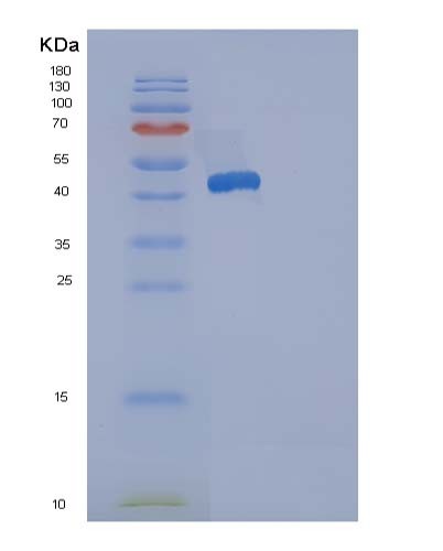 Human ACP1 (Low Molecular Weight Phosphotyrosine Protein Phosphatase) - Recombinant Protein