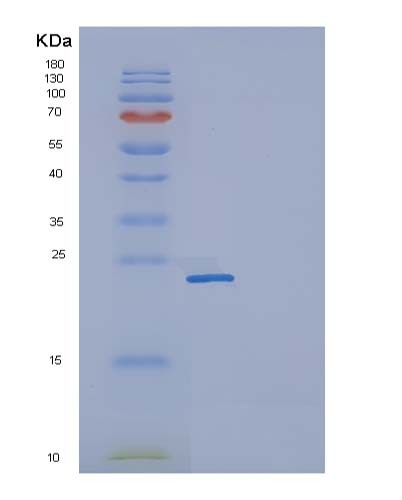 Human FCGR2A (Low Affinity Immunoglobulin Gamma Fc Region Receptor Ii-A) - Recombinant Protein