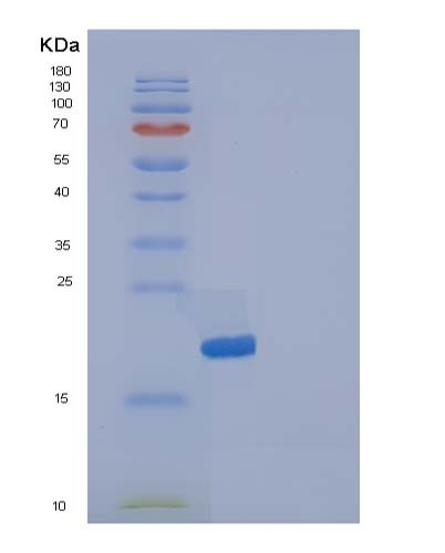 Human IL36RN (Interleukin-36 Receptor Antagonist Protein) - Recombinant Protein