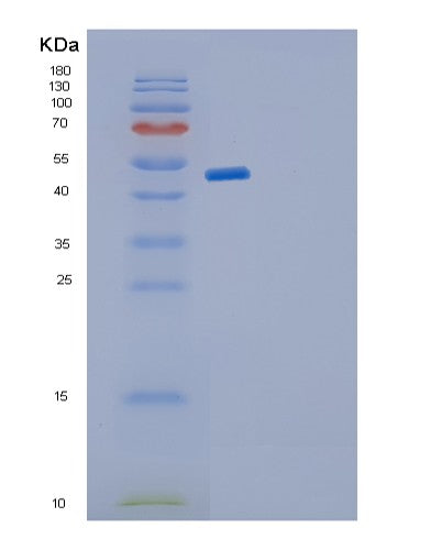 Human GDI2 (Rab Gdp Dissociation Inhibitor Beta) - Recombinant Protein