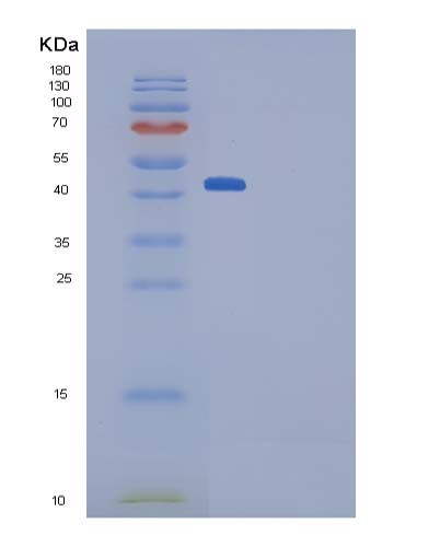 Mouse Ptn (Pleiotrophin) - Recombinant Protein