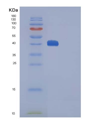 Mouse Ctla4 (Cytotoxic T-Lymphocyte Protein 4) - Recombinant Protein