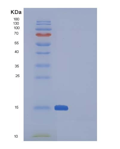 Human SNCA (Alpha-Synuclein) - Recombinant Protein