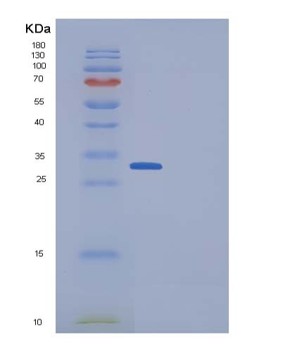 Human DKK1 (Dickkopf-Related Protein 1) - Recombinant Protein