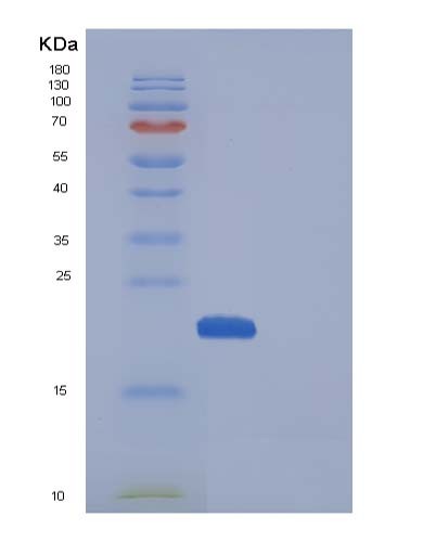 Mouse Manf (Mesencephalic Astrocyte-Derived Neurotrophic Factor) - Recombinant Protein