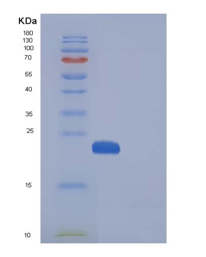 Human MANF (Mesencephalic Astrocyte-Derived Neurotrophic Factor) - Recombinant Protein