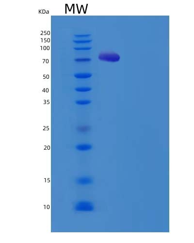 Human PDE9A (High Affinity Cgmp-Specific 3',5'-Cyclic Phosphodiesterase 9A) - Recombinant Protein