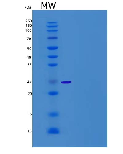 Mouse Cd200r4 (Cell Surface Glycoprotein Cd200 Receptor 4) - Recombinant Protein