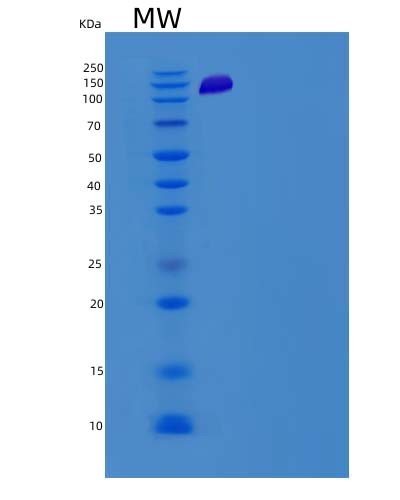 Mouse Prkcd (Protein Kinase C Delta Type) - Recombinant Protein