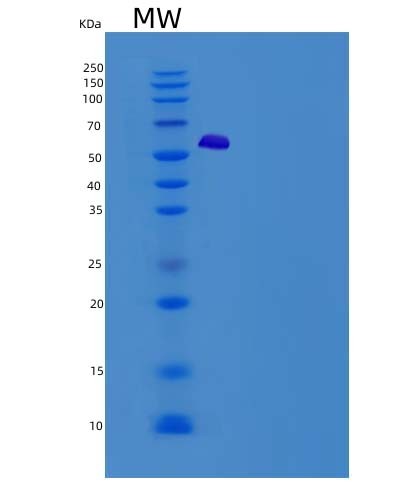 Human TWF1 (Twinfilin-1) - Recombinant Protein
