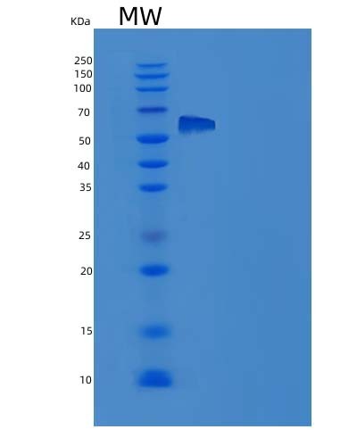 Human IL1RAPL1 (Interleukin-1 Receptor Accessory Protein-Like 1) - Recombinant Protein