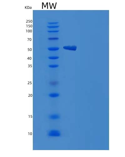 Human MAPK9 (Mitogen-Activated Protein Kinase 9) - Recombinant Protein