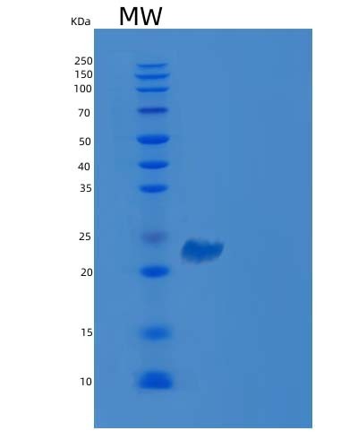 Human VSIG2 (V-Set And Immunoglobulin Domain-Containing Protein 2) - Recombinant Protein